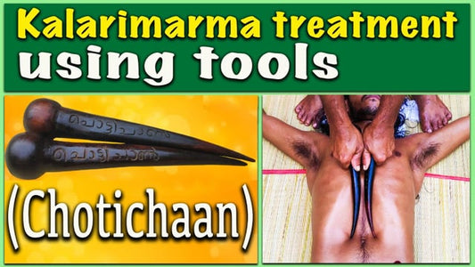 Tool therapy segment in Kalari marma therapy - chotichaan (Duration : 02:34:17)